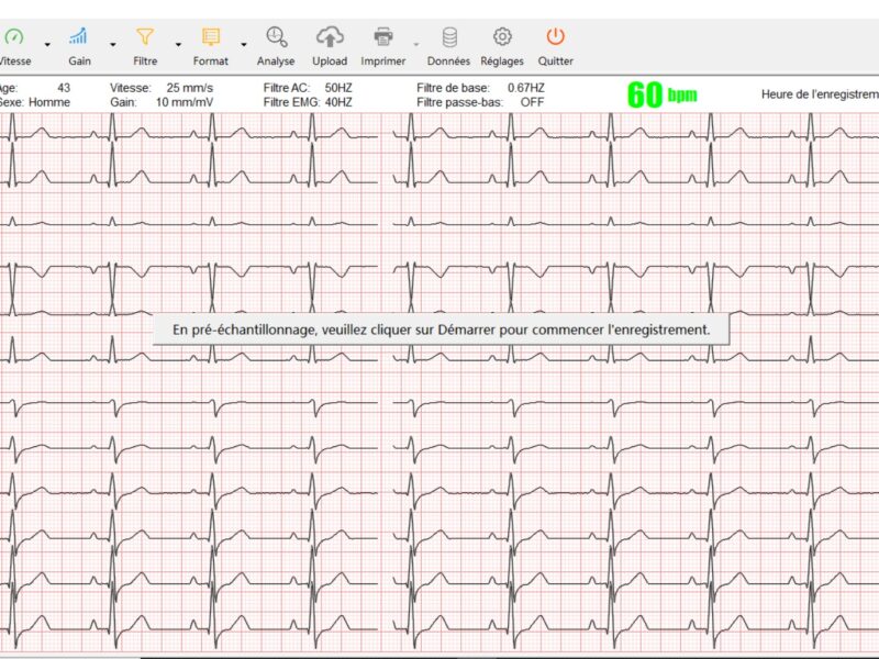 Cardiomate PC-ECG