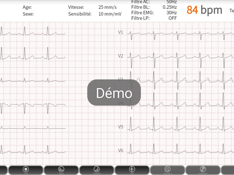 Cardiomate PC-ECG