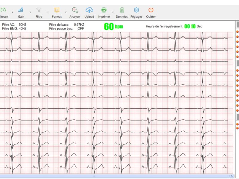 Cardiomate PC-ECG