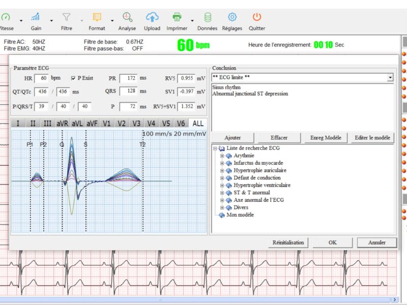 Cardiomate PC-ECG